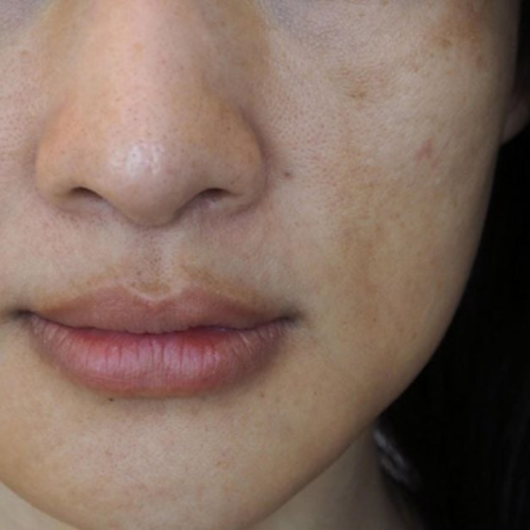 Thiết kế chưa có tên