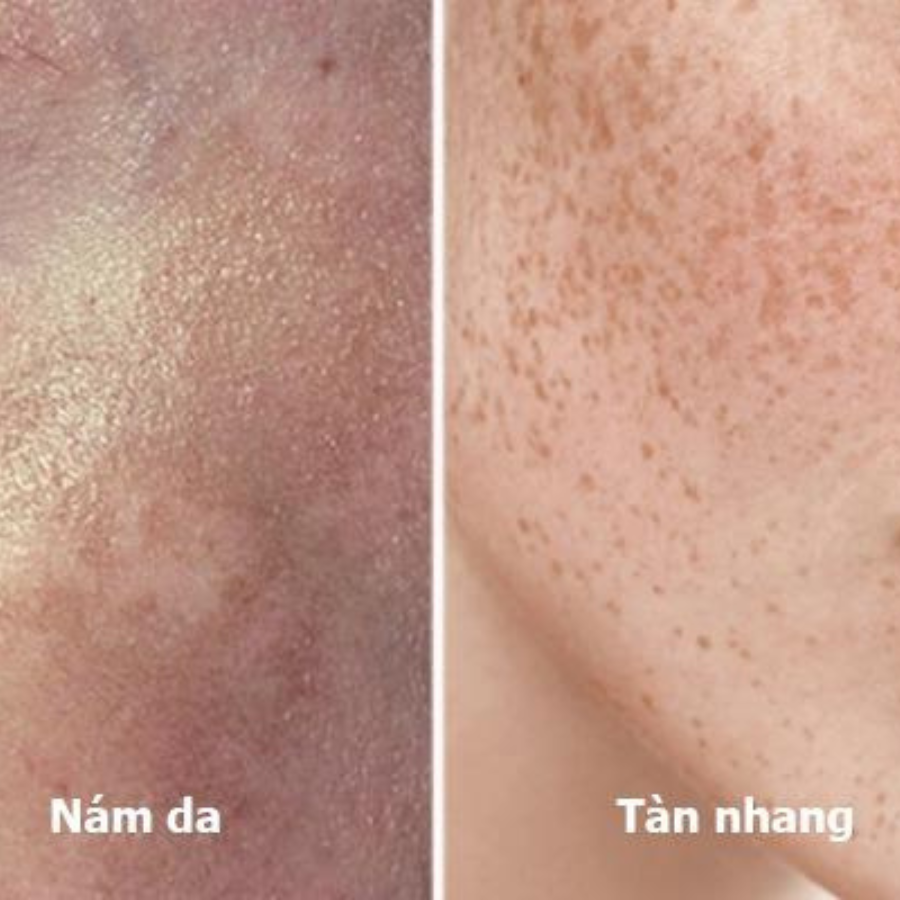 nam-tan-nhang